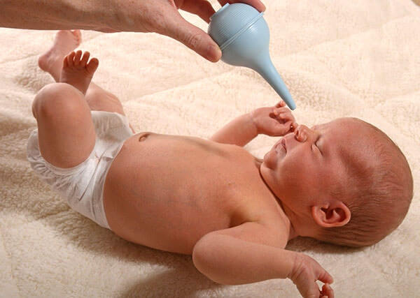 Если у малыша насморк, нужно вытянуть сопли грушей или аспиратором