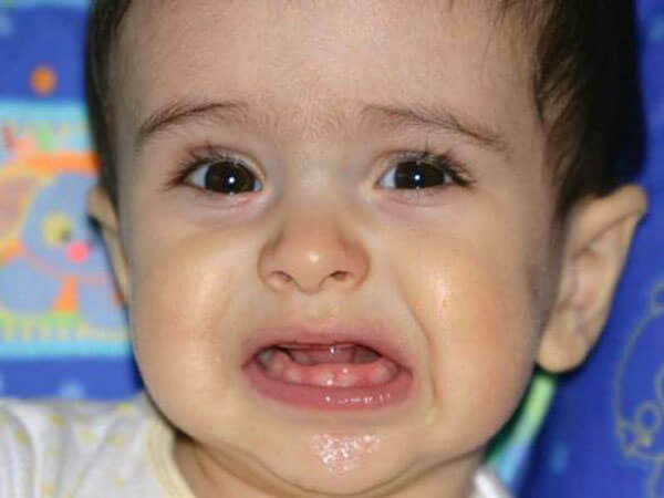 Когда у малыша режутся зубы, возможно появление насморка