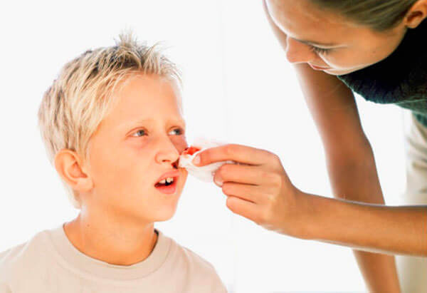 Причиной частых кровотечений из носа у ребенка могут быть более серьезные болезни