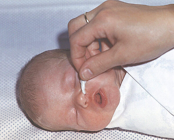 Прозрачные сопли у младенца требуют только регулярной чистки носика