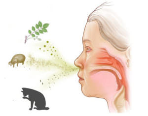 Одной из причин заложенности носа и сильного насморка является аллергия