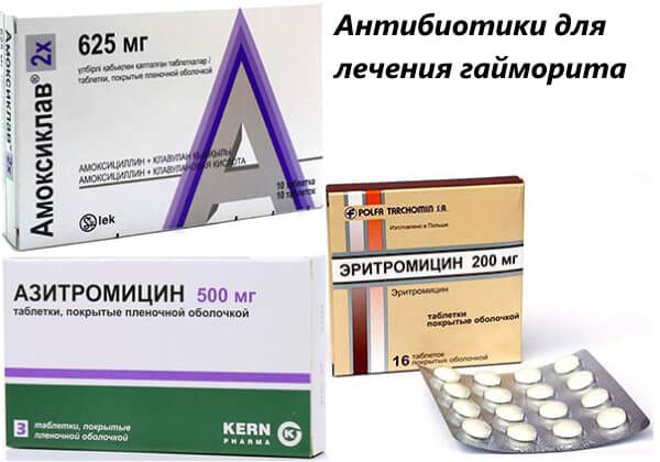 Антибиотики для лечения гайморита