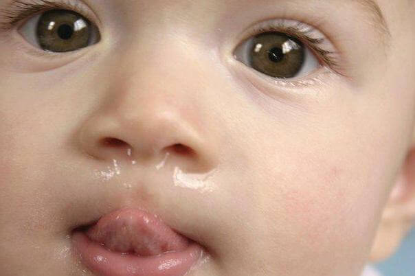 У ребенка течет из носа